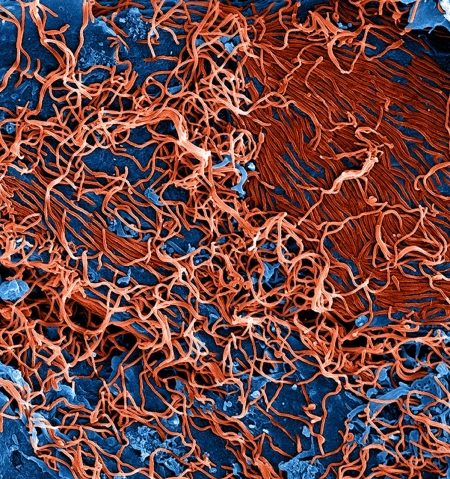 Viral Hemorrhagic Fever (Ebola virus disease, Lassa fever, Marburg virus) Viral Hemorrhagic Fever (Ebola virus disease, Lassa fever, Marburg virus)
